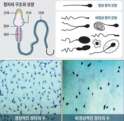 정자, 자가검사시대 개막